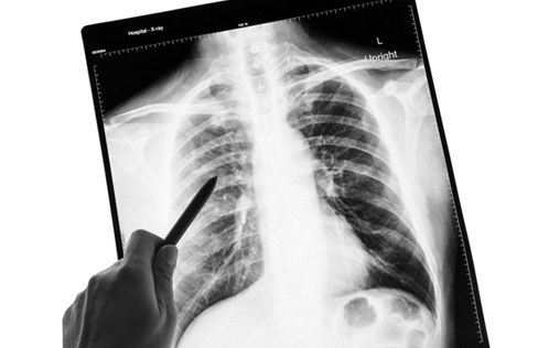 Imagen para el diagnóstico y medicina nuclear | Formación Profesional Liceo